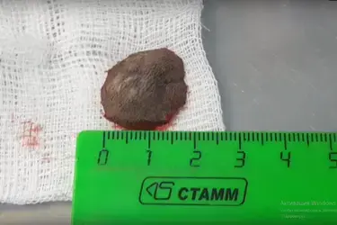 Врачи ивановского зоопарка удалили опухоль морской свинке