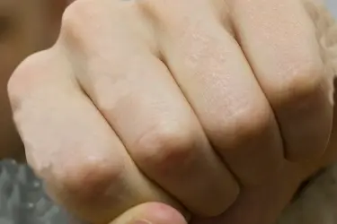 В Родниках судят мужчину, который ударил в челюсть подростка