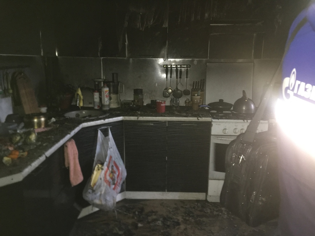 Мужчину госпитализировали вследствие пожара в Шексне