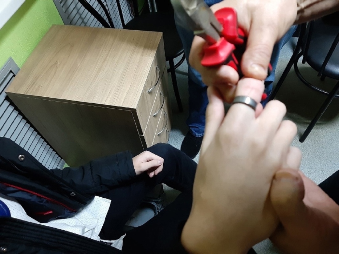 Череповецкий подросток едва не лишился пальца из-за шутки друзей