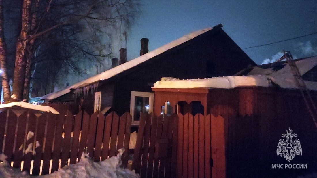 52-летний мужчина получил сильные ожоги при пожаре в Бабаево