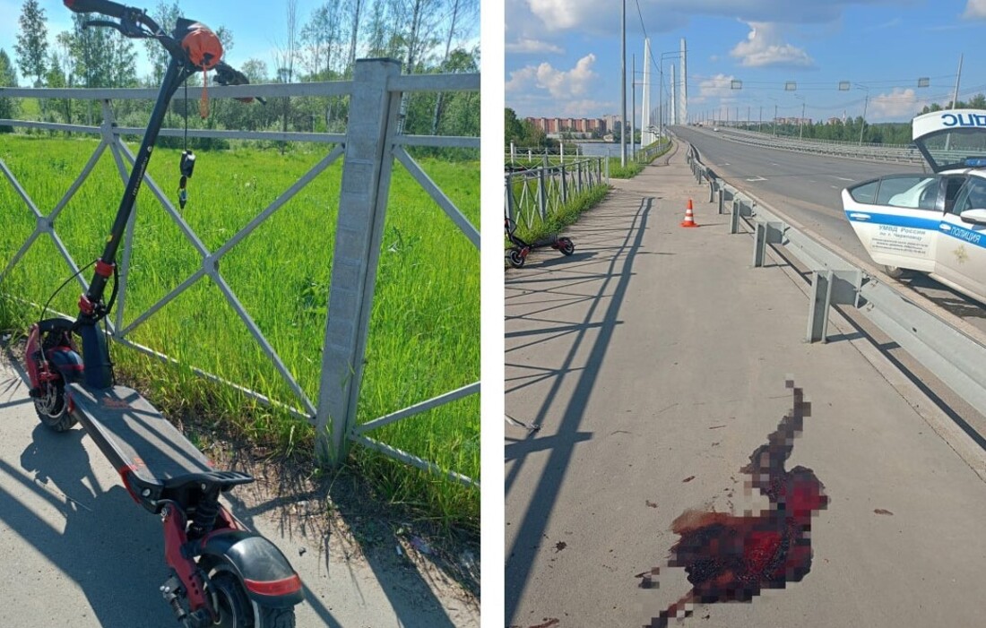 Упавший с электросамоката череповчанин скончался в больнице