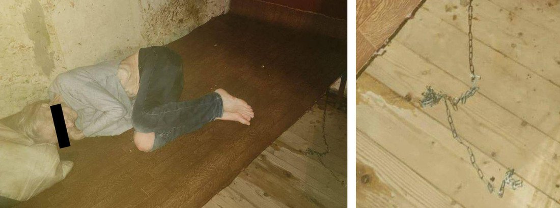 Скотское отношение: пожилую женщину приковали цепью и содержали как собаку в Бабаевском округе