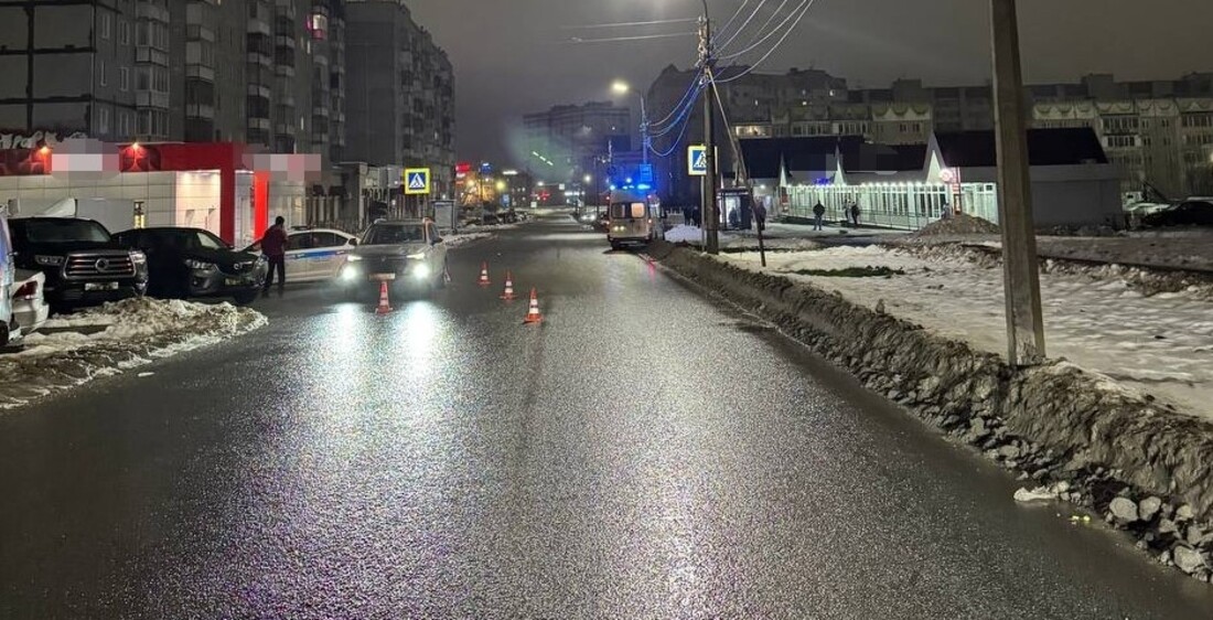 Череповчанка, попавшая под колёса автомобиля, скончалась в больнице