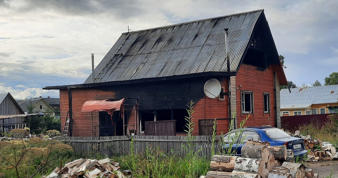 Житель Белозерска получил ожоги при тушении пожара в собственном доме