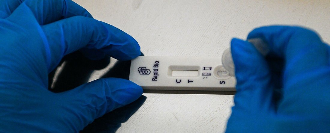 Экспресс-тесты на COVID будут проводиться в прививочных пунктах Вологды и Череповца