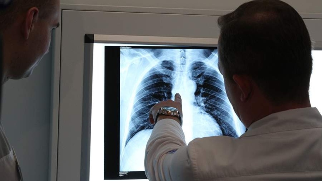 Новую систему ранней диагностики рака лёгких представили в Вологде