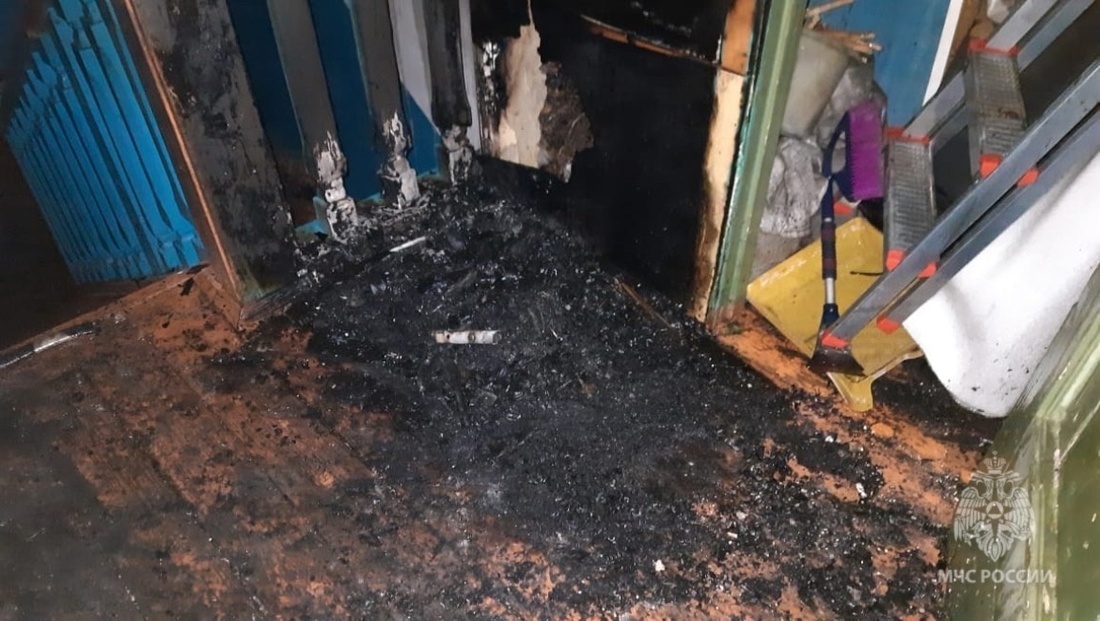 65-летний вологжанин получил серьезные ожоги в собственной квартире